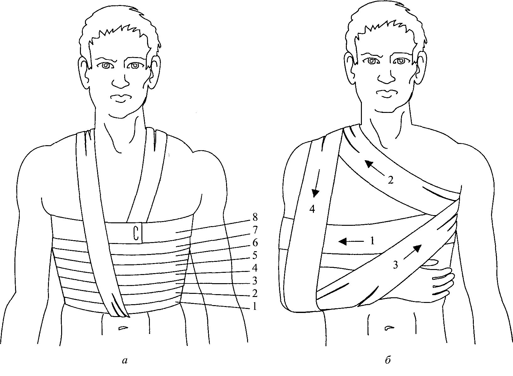Десмургия повязка Дезо. Перевязки бинтом Дезо. Десмургия повязки на грудную клетку. Повязка Дезо при переломе ключицы.