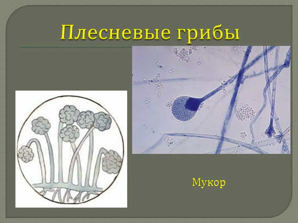 Плесневые грибы мукор. Плесневый гриб мукор. Мукор синцитий. Мукор на Сабуро. Плесневый гриб мукор относится к