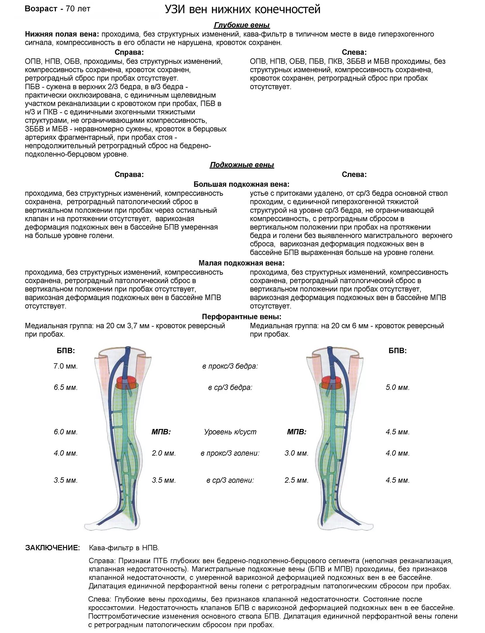 Как называется узи вен. Тромбоз вен нижних конечностей протокол УЗИ. Расшифровка УЗИ нижних конечностей вен. Протокол УЗИ вен нижних конечностей при тромбозе. БПВ на УЗИ вен нижних конечностей.