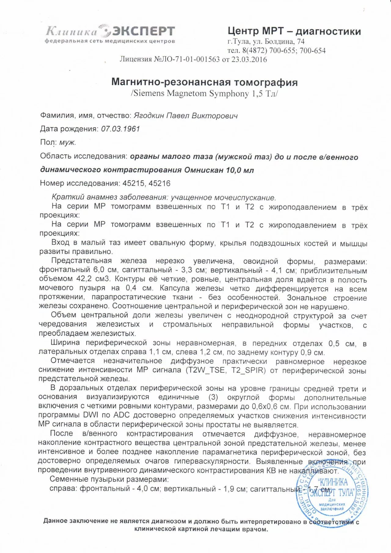 Карцинома мрт предстательной железы. Мрт мочевого пузыря заключение. Заключение мрт предстательной железы. Мрт малого таза(простаты. Мрт мочевого пузыря заключение.
