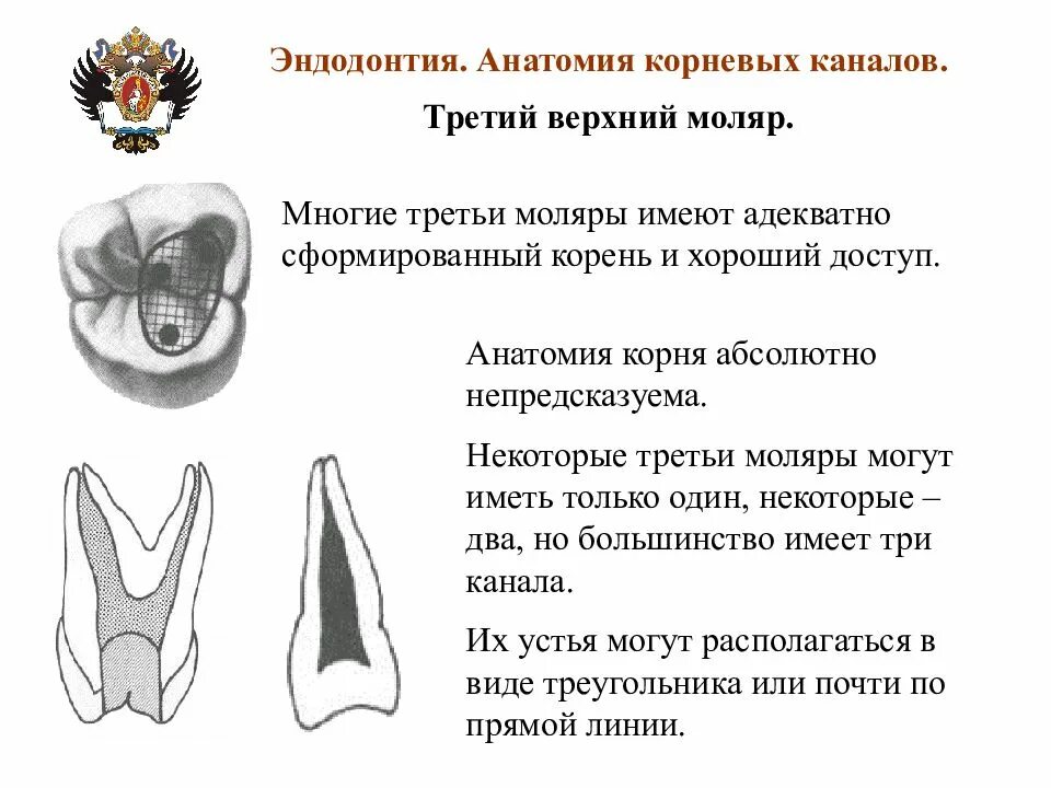 Верхние и нижние каналы. Анатомия корневых каналов 1 моляр верхний челюсть. Нижний моляр анатомия корневых каналов. Название корневых каналов моляров нижней челюсти. Названия корневых каналов в молярах верхней челюсти.