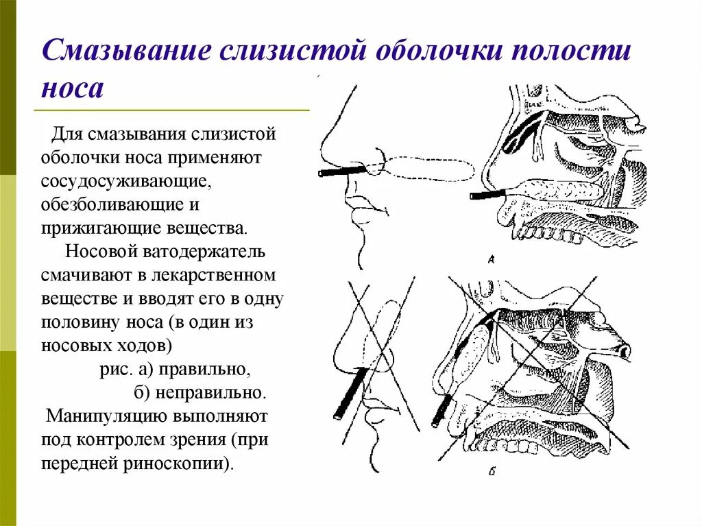 Как восстановить слизистую после сосудосуживающих. Анемизация слизистой оболочки носа. Смазывание слизистой оболочки носа. Слизистой оболочке носовой полости. Слизистую оболочку носа.