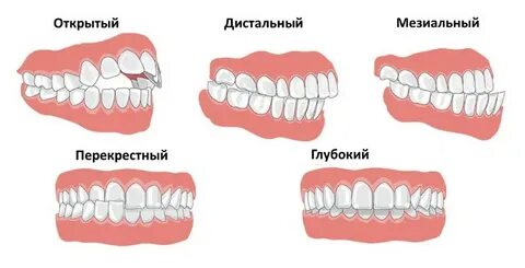 Прикусом называется