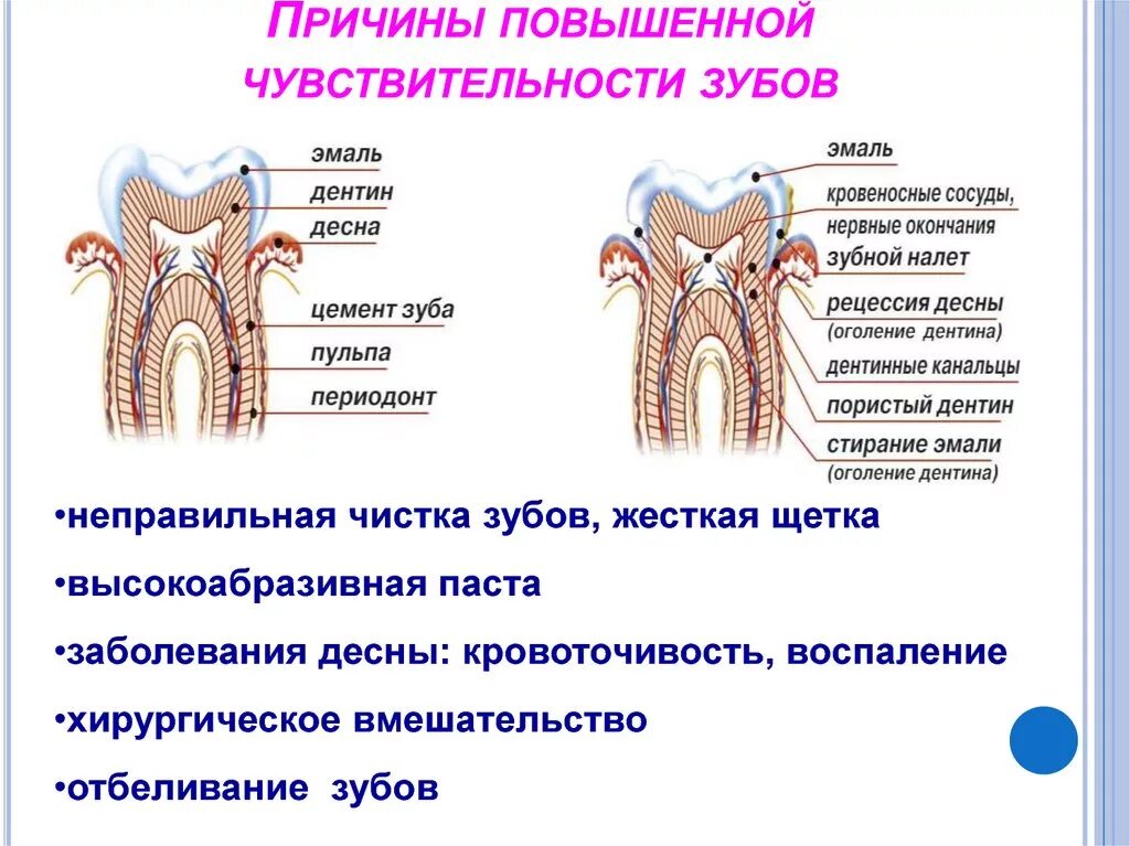 Причины почему болит зуб. Повышенная чувствительность зубов. Причины повышенной чувствительности зубов. Повышение чувствительности зубов. Чувствительность зуба причины.