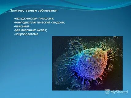 Злокачественные лимфомы