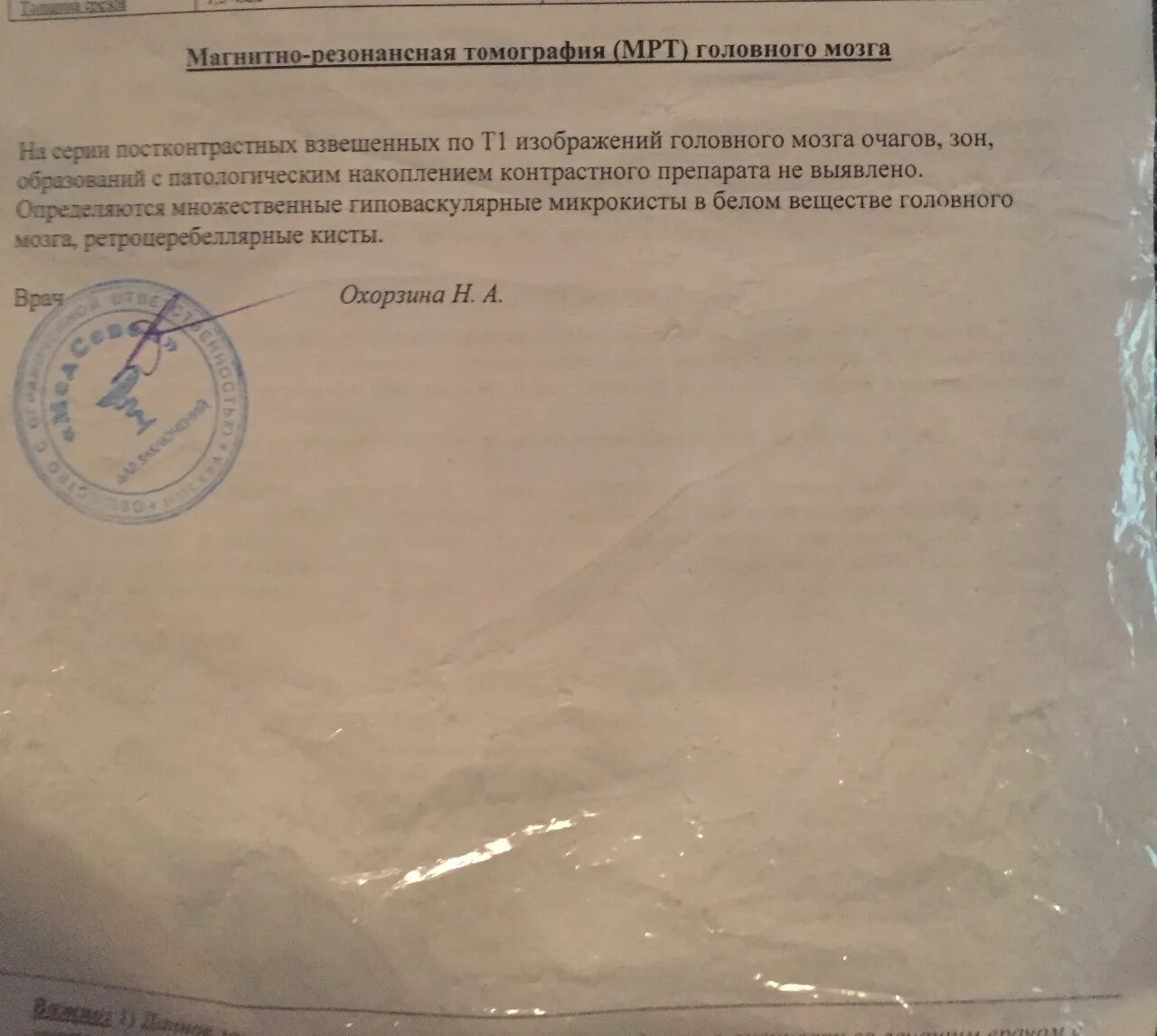 Киста головного мозга заключение. Справка киста головного мозга. Мрт заключение о кисте. Норма кист головного мозга.