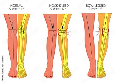 Что значит leg
