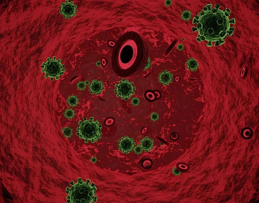 Заражение крови симптомы фото. Сосуды после коронавирус. Памятка для переболевших коронавирусом. Сосуды после коронавирус. Бактерия ковид 19.