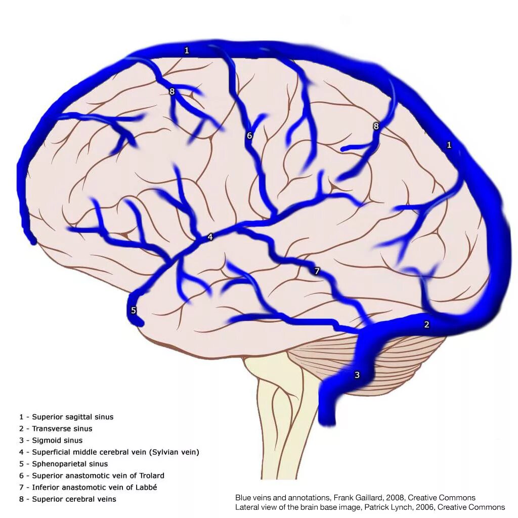 Вены головного мозга. Большая Вена головного мозга (Вена Галена) ВПА. Вена Галена венозный отток. Вена Галена анатомия. Вена Лаббе.