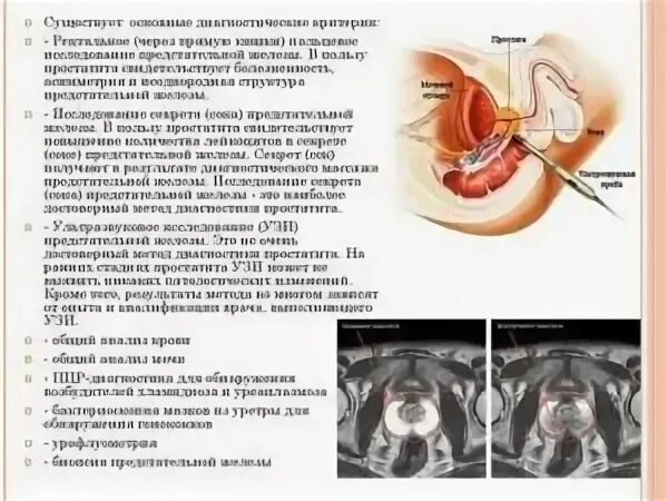 Трузи подготовка к исследованию мужчинам