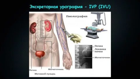 Урография что это