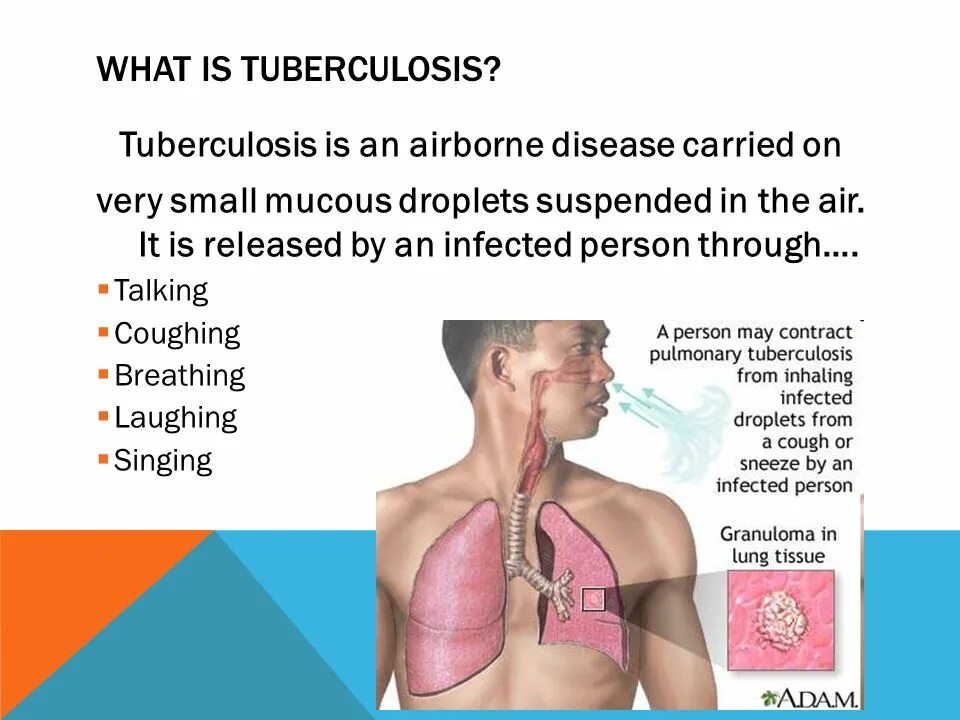 Туберкулез на английском. Симптомы туберкулеза на английском языке. Prevention of tuberculosis.