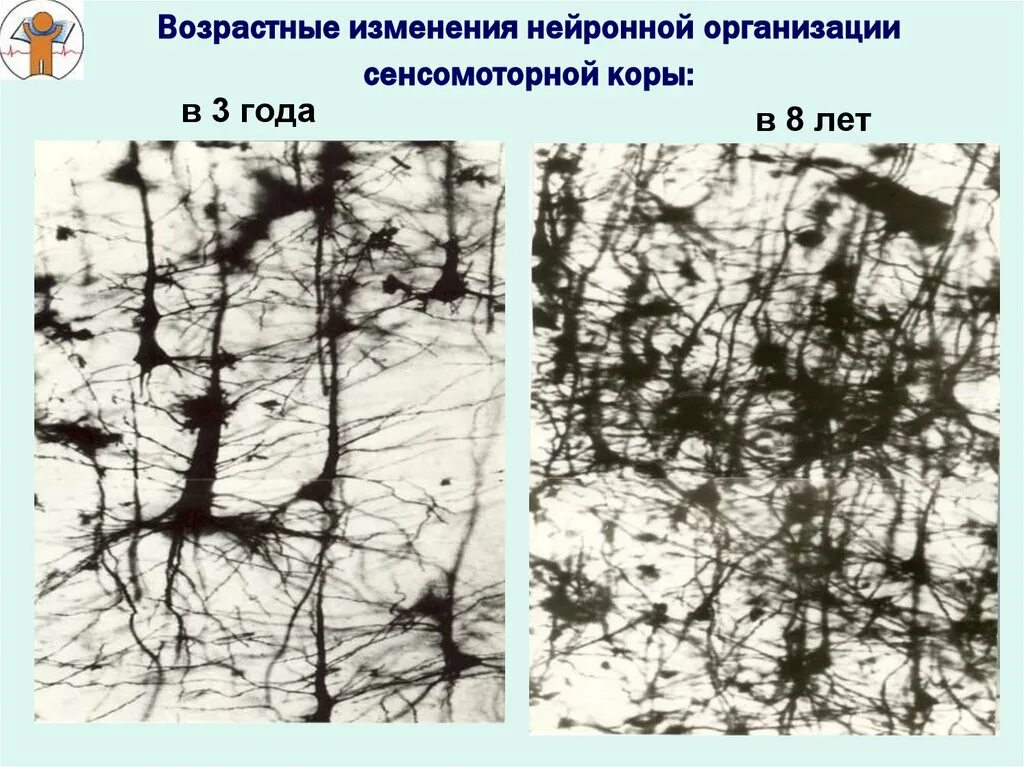 Возрастные изменения коры головного мозга. Возрастные изменения нейронной организации коры головного мозга. Возрастные изменения коры ГМ. Нейрогенез коры головного. Возрастные изменения мозга