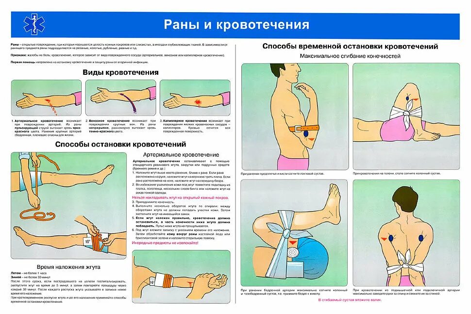 Способы остановки кровотечения схема. Методы временной остановки кровотечения при оказании первой помощи. Кровотечение методы остановки кровотечения. Методы временной остановки кровотечени. Останавливать кровотечение путем