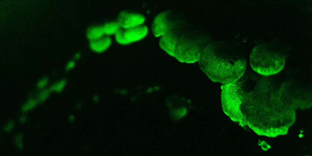 Свечение гниющего дерева вызывается. Биолюминесцентные бактерии. биолюминесценция деревьев. свечение гниющего дерева. гниющее дерево светится в темноте.