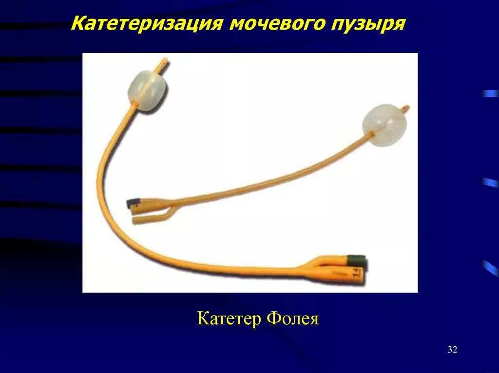 Как убрать катетер. Катетер мочевого пузыря алгоритм. Катетер Померанцева-Фолея строение. Катетеризация мочевого пузыря Фолея. Алгоритм катетеризации мочевого пузыря одноразовым катетером Фолея.