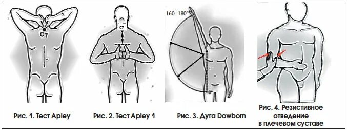Боль в руке при поднятии и отведении. Тест болезненной дуги в плечевом суставе. Тест на подвижность плечевых суставов. Наружная и внутренняя ротация плеча. Внутренняя ротация плечевого сустава.