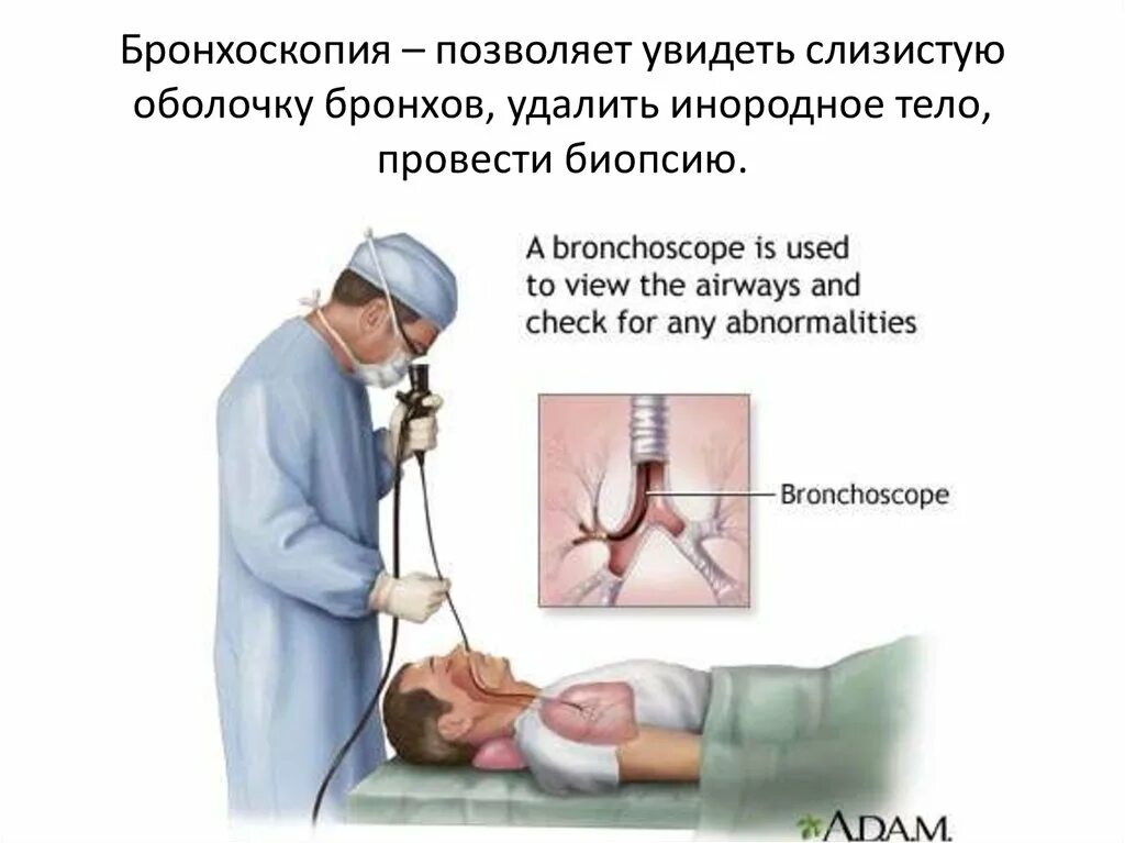 Бронхоскопия и бронхография. Фибробронхоскопия с биопсией. Санационная бронхоскопия. Ателектаз бронхоскопия. В легкие через нос