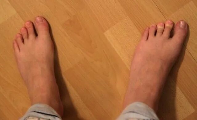 Leave the foot. [jius]ankletset02-left. Моя левая левая нога 1989 постер. Have two left feet. Красивые пяточки.