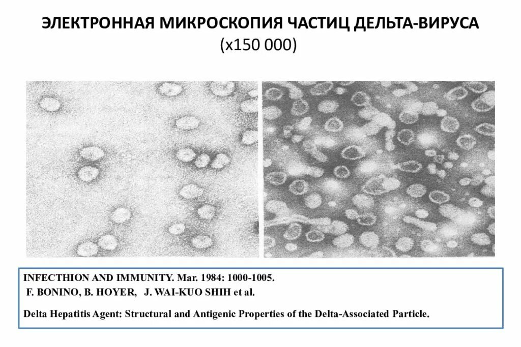 Гепатит в без дельта агента. Электронная микроскопия вирусов. Вирус в электронном микроскопе. Вирус гепатита Дельта.