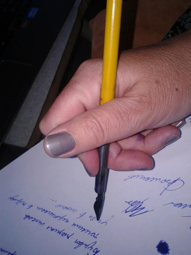 Черная ручка плохо пишет. Неправильно держит ручку при письме. Хват ручки. Рука при письме. Рука с ручкой.
