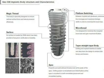 Neobiotech импланты отзывы