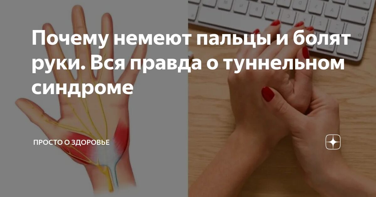 Пальцы рук немеют что делать как лечить. Болит рука и немеют пальцы. онемение рук туннельный синдром. болит кисть немеют пальцы.