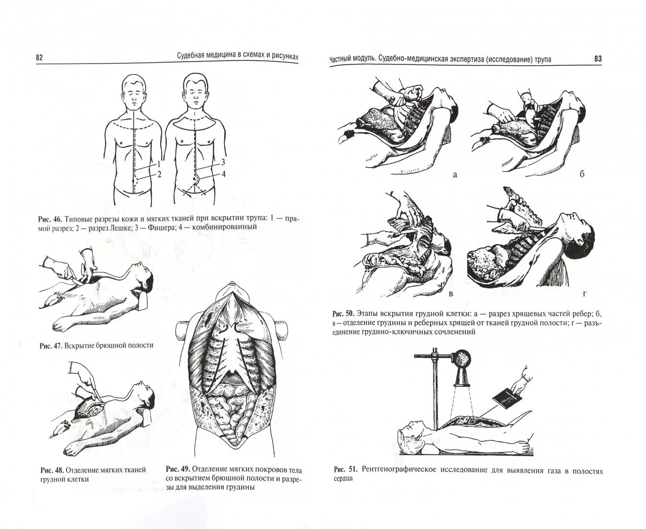 Судебно медицинская медицина. Судебная медицина в схемах и рисунках. Судебная медицина в схемах и таблицах. Ромодановский п.о судебная медицина. Судебная медицина Ромодановский.