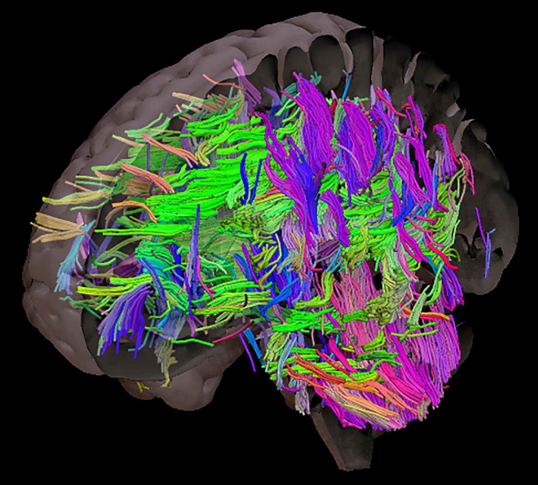 Нейровизуализация головного мозга. Нейровизуализация фото. Альцгеймер снимки мозга.