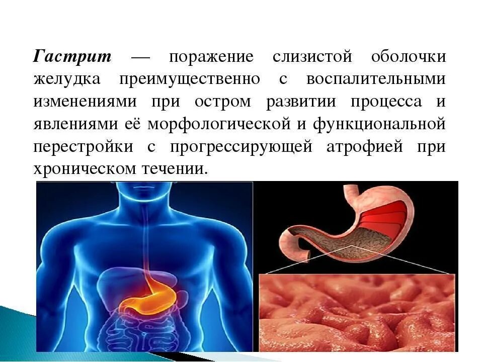Как лечить желудок симптомы