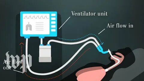 how does a ventilator work mechanically - lollmim.ru.
