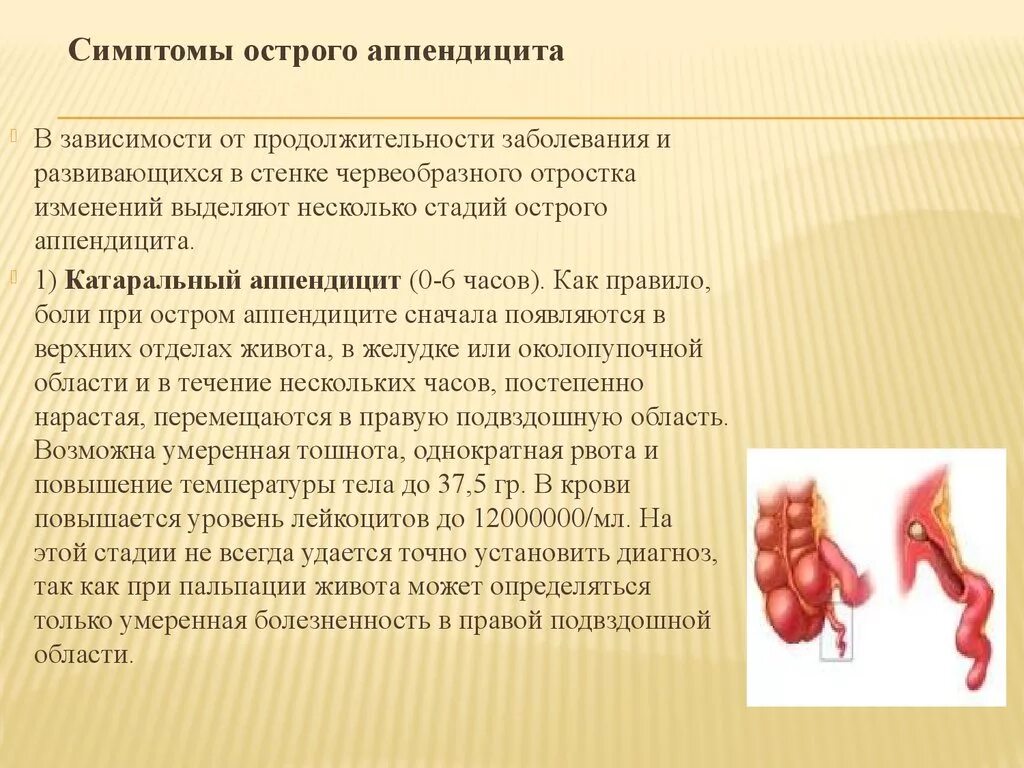 Что делать при подозрении на аппендицит. Острый катаральный аппендицит. Воспаление аппендицита.