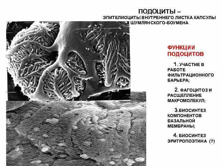 Подоциты почки функции. Клетки подоциты. Подоцит строение. Строение фильтрационного барьера почки. Базальная мембрана фильтрационного барьера почки.