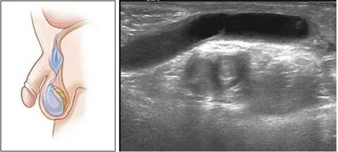 3G порно видео