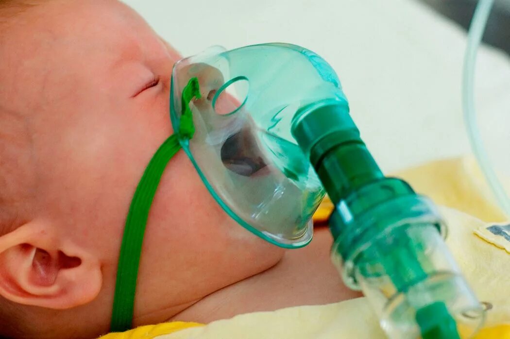 Осложнения сепсиса новорожденных. Ивл сепсис. Аппарат ивл для недоношенных новорожденных. При сепсисе развивается. Сепсис новорожденных презентация.