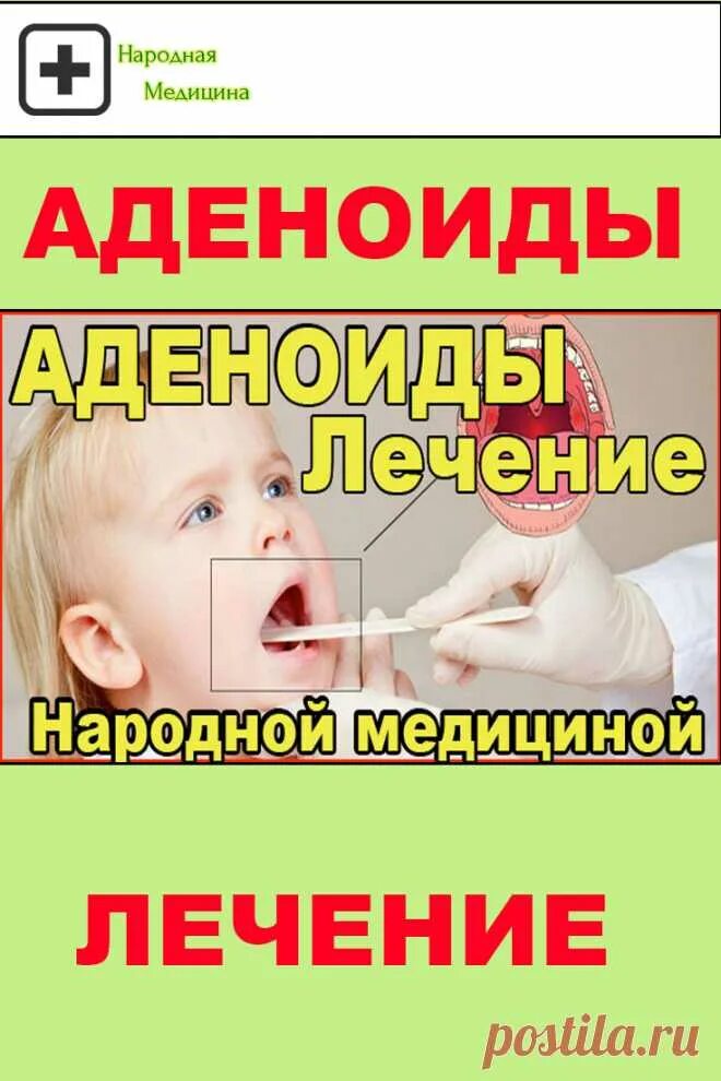 Аденоиды народное лечение. Аденоиды лекарства. Аденоиды лекарства для детей. Аденоиды лечение у детей лекарства. Аденоиды у детей народные средства.