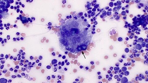 Candida sp