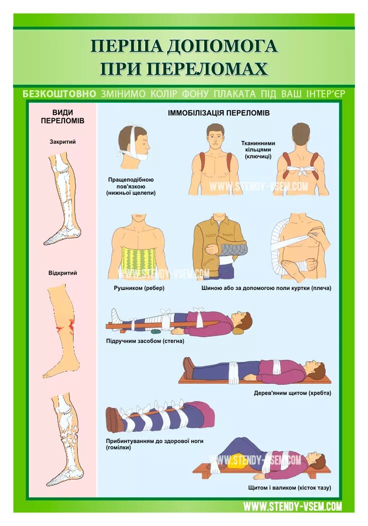 Памятки об оказании помощи при переломах. Алгоритм действий при переломе. При оказании первой помощи при переломе. Оказание первой мед помощи при переломе костей конечностей. Памятка при оказании первой помощи при переломах.