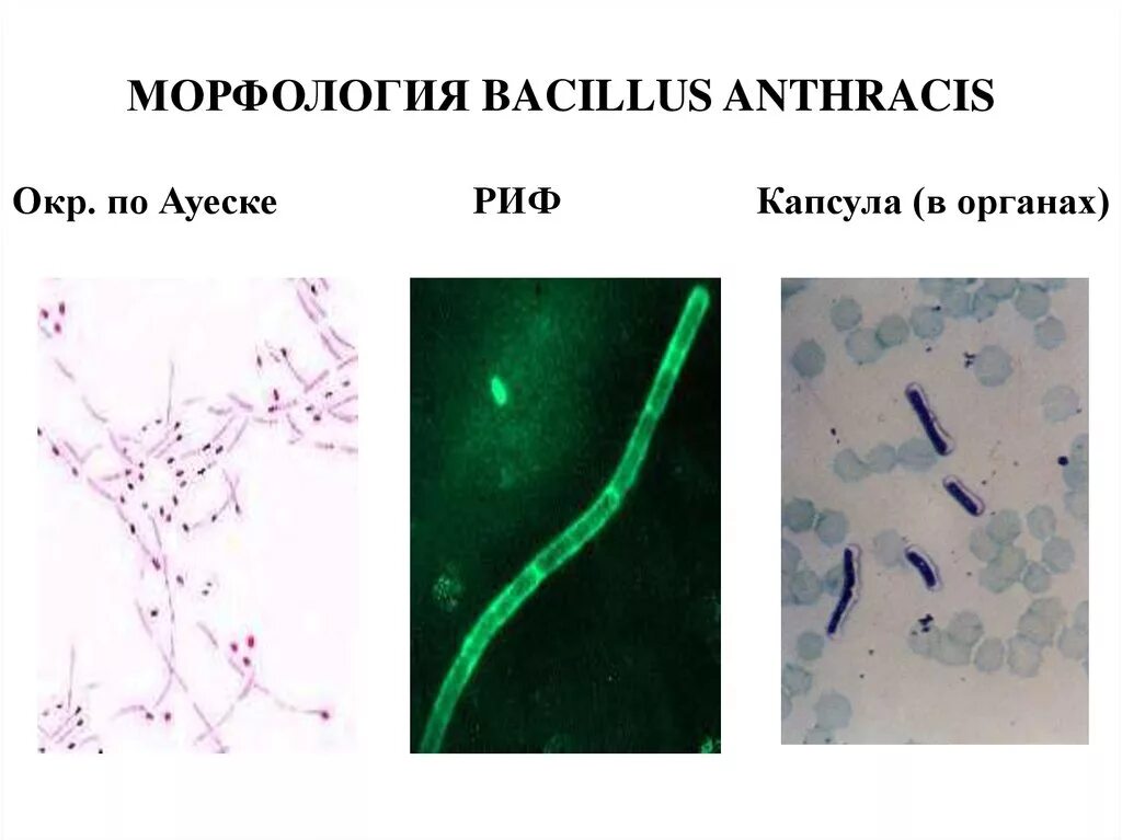 Bacillus anthracis микробиология. Возбудитель сибирской язвы микроскопия. Бацилла сибирской язвы Bacillus anthracis.