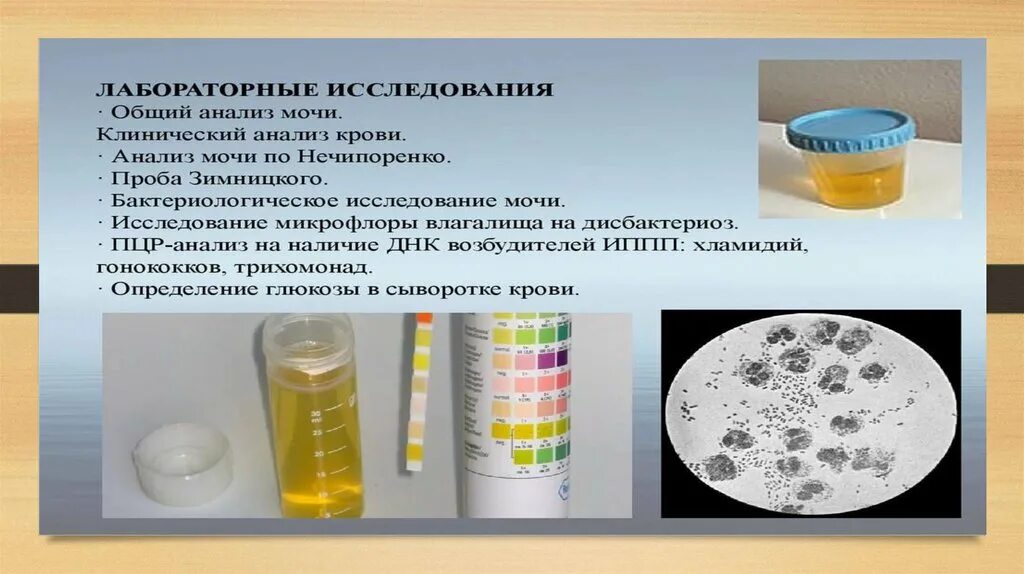 Сдача утренней мочи. Методы исследования мочи нечипоренко. лабораторные исследования мочи. общий анализ мочи. подготовка к оам по нечипоренко.