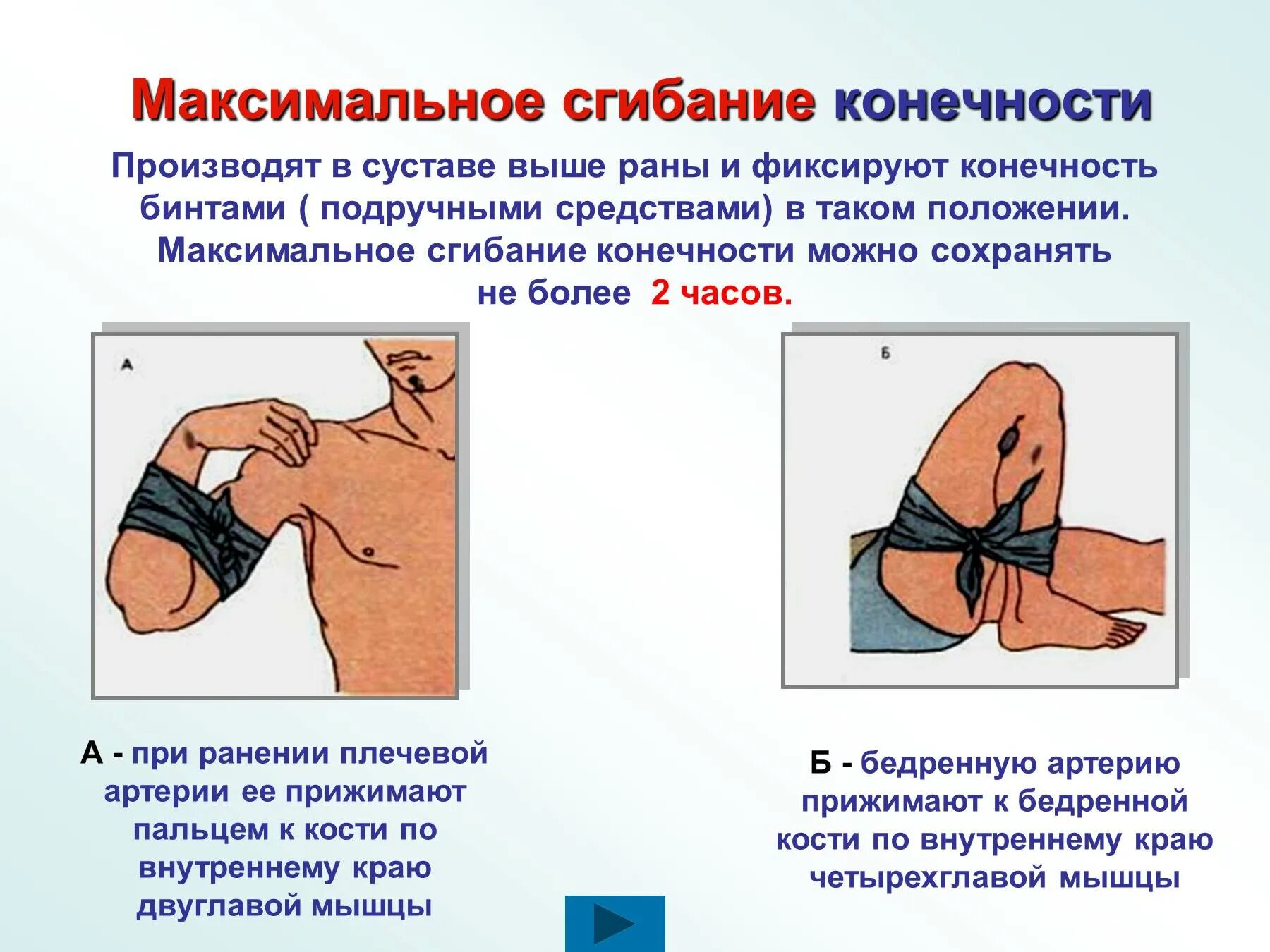 При каком кровотечении применяется. Остановка кровотечения методом максимального сгибания. максимальное сгибание конечности при артериальном кровотечении. максимальное сгибание конечности для остановки кровотечения. остановка кровотечения максимальным сгибанием конечности алгоритм.