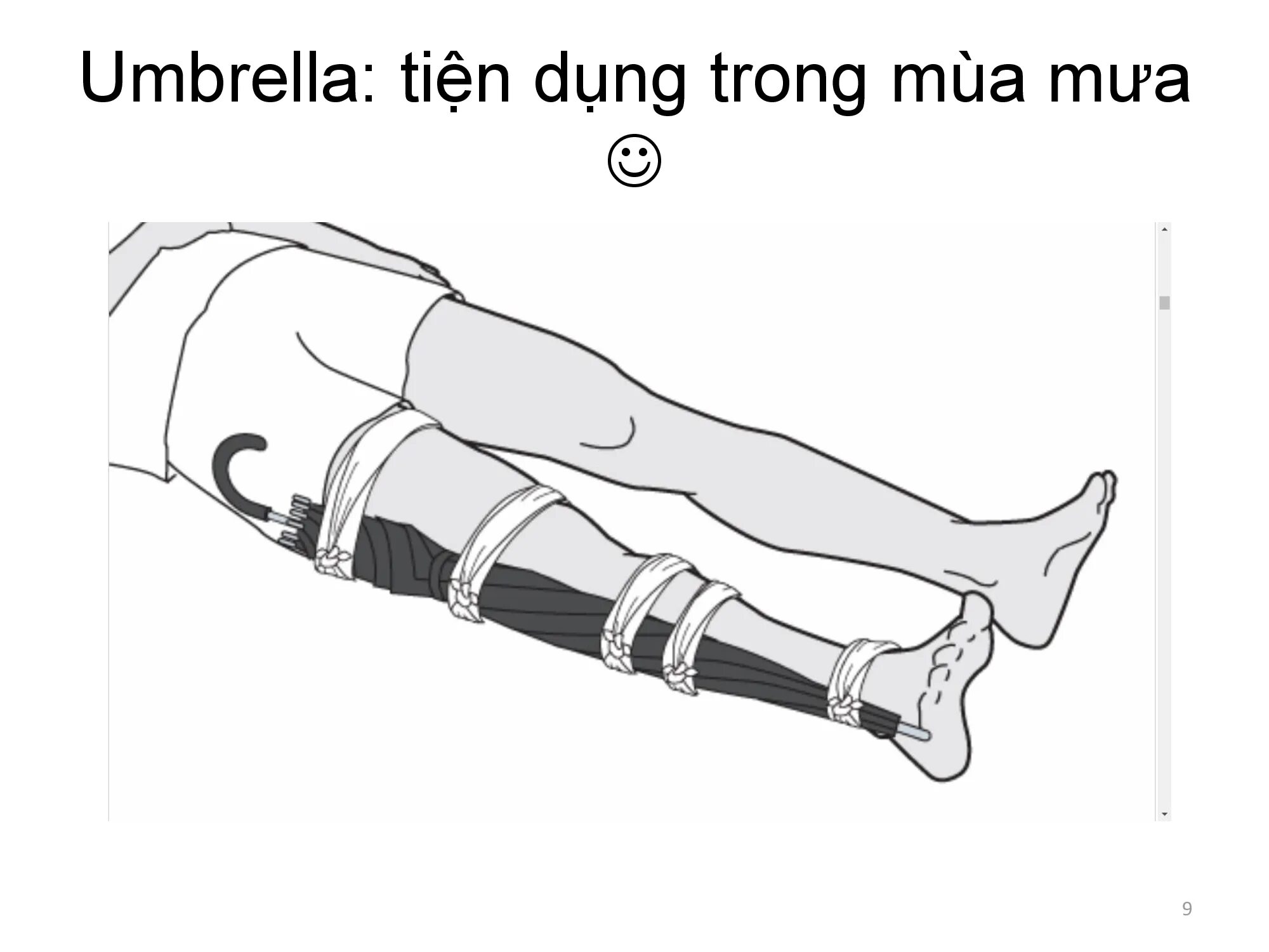 Иммобилизация конечности при переломе тазобедренного сустава. Пелолом кости голени наложения жины. Шина на месте перелома. Шина на месте перелома. Иммобилизация при переломах костей.