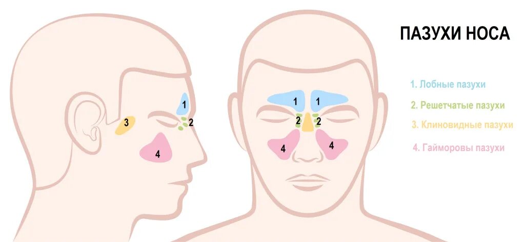 Клиновидная пазуха носа. Клиновидная пазуха носа воспаление. Воспаление клиновидной пазухи симптомы. Промывание клиновидной пазухи.