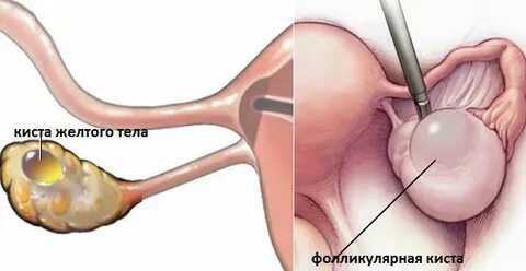 Анасы ұлының жыныс мүшесін көрді