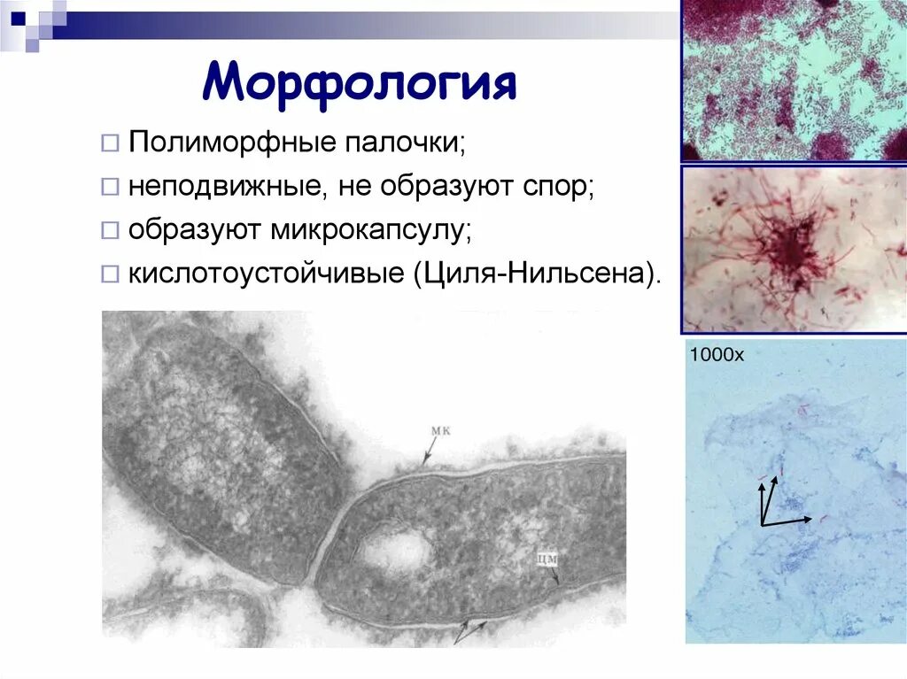 Микобактерии возбудители туберкулеза. Микобактерии туберкулеза микробиология морфология. Туберкулезная палочка морфология. Микобактериум туберкулёзис морфология.