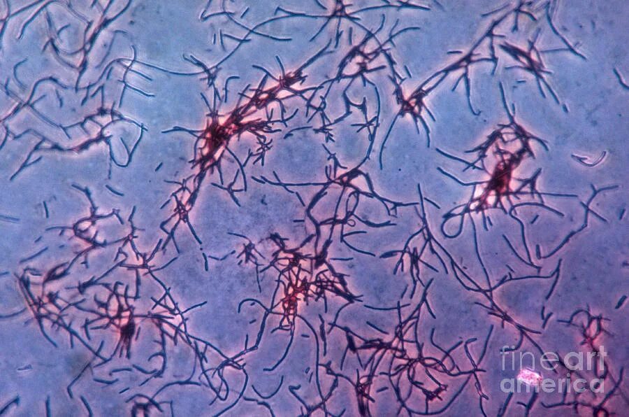 Бифидобактерии в кале. Ацидофильные лактобактерии (Lactobacillus Acidophilus). Lactobacillus Acidophilus микроскопия. Lactobacillus Acidophilus под микроскопом. Бифидум бактерии микроскопия.