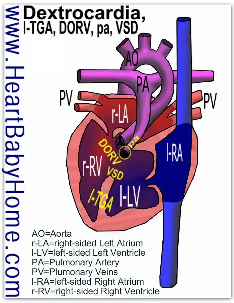 Left sided 2. Left sided 2. Brain left and right hemisphere. Left vs right. Congestive heart failure symptoms in children.
