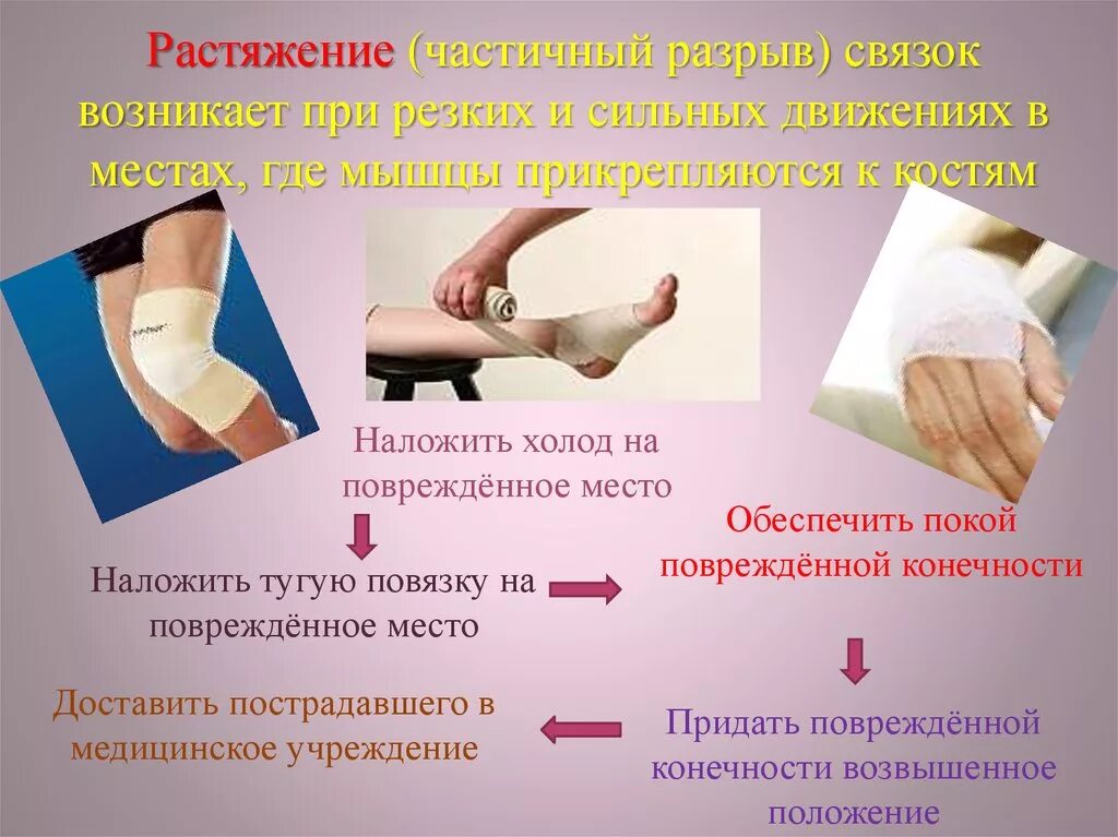 Какую первую помощь оказывают при растяжении. Алгоритм оказания первой помощи при растяжении. оказание первой помощи при растяжении и разрыве связок. оказание пмп при растяжении связок. оказание первой доврачебной помощи при растяжении связок.