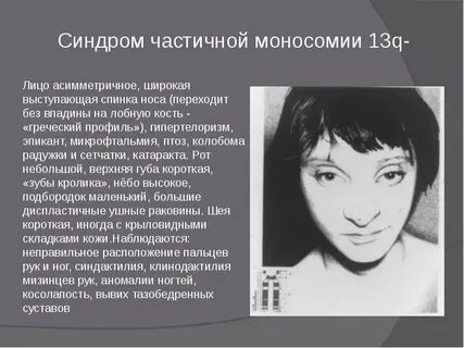 Синдром связанный