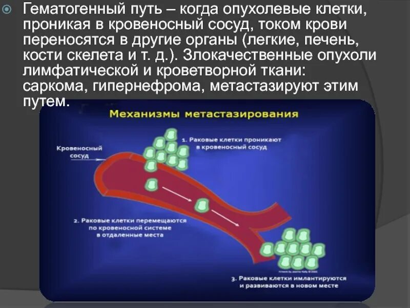 Гематогенное метастазирование. Гематогенный и лимфогенный путь передачи. гематогенный путь метастазирования. гематогенное метастазирование опухоли. гематогенный путь распространения опухоли.